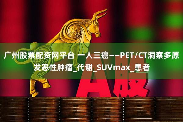 广州股票配资网平台 一人三癌——PET/CT洞察多原发恶性肿瘤_代谢_SUVmax_患者